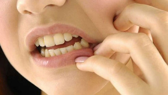 طب سنتي؛ بهترين روش درمان آفت دهان
