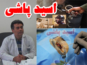 اسيدپاش تهران کيست؟/آخرين وضعيت درمان مصدوم حادثه /تشکيل تيم ويژه دستگيري