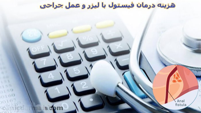 روش‌های درمان فیستول و مقایسه هزینه در سال 1402