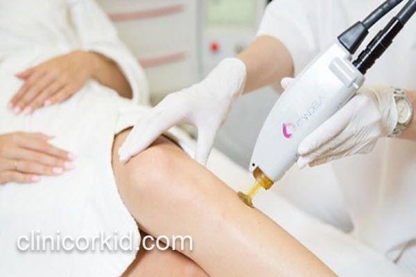 بهترین مرکز لیزر الکساندرایت کندلا&nbsp;| کلینیک ارکید